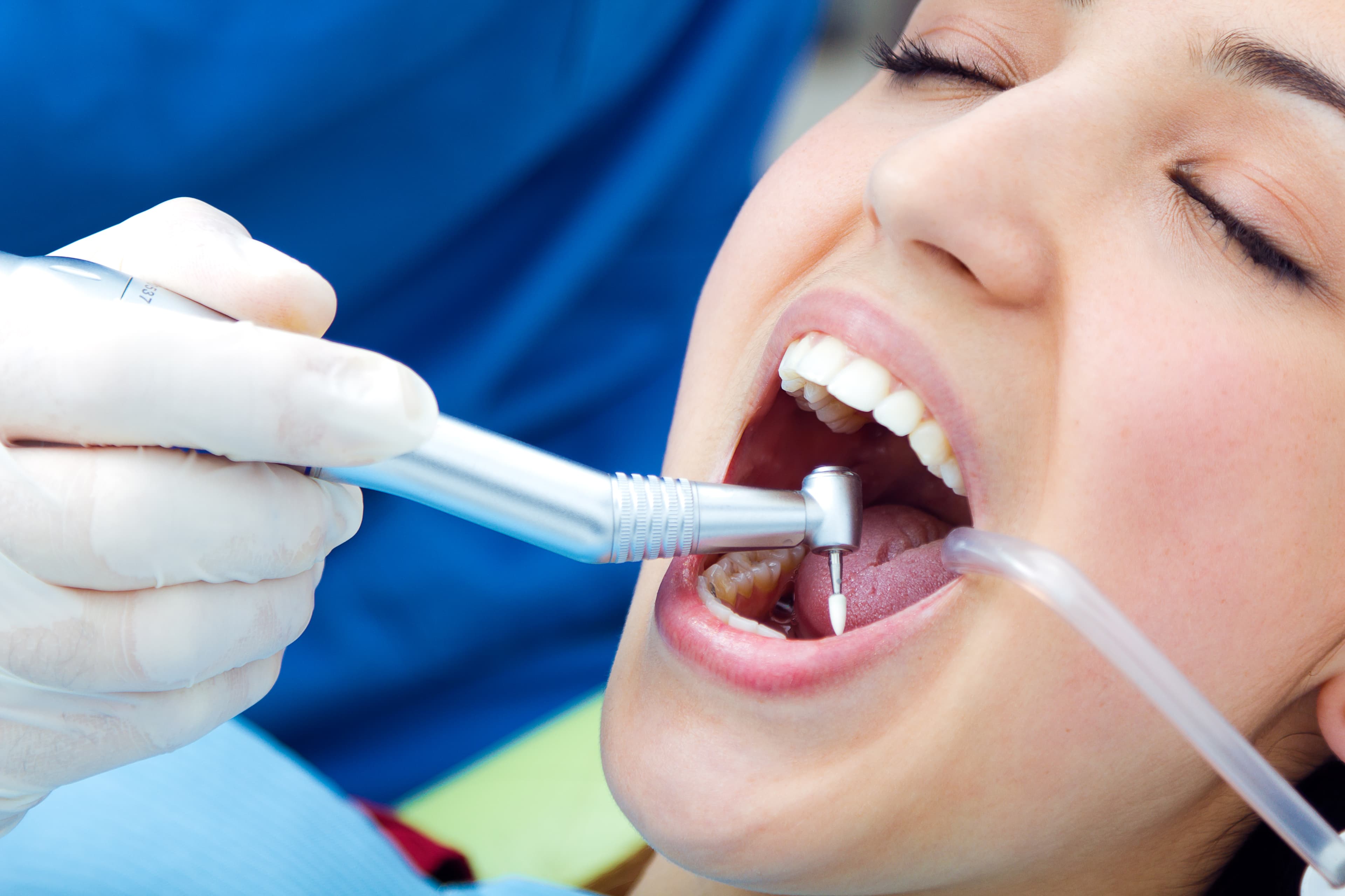 Emergency Root Canal & Endodontic Treatment in Vijayawada